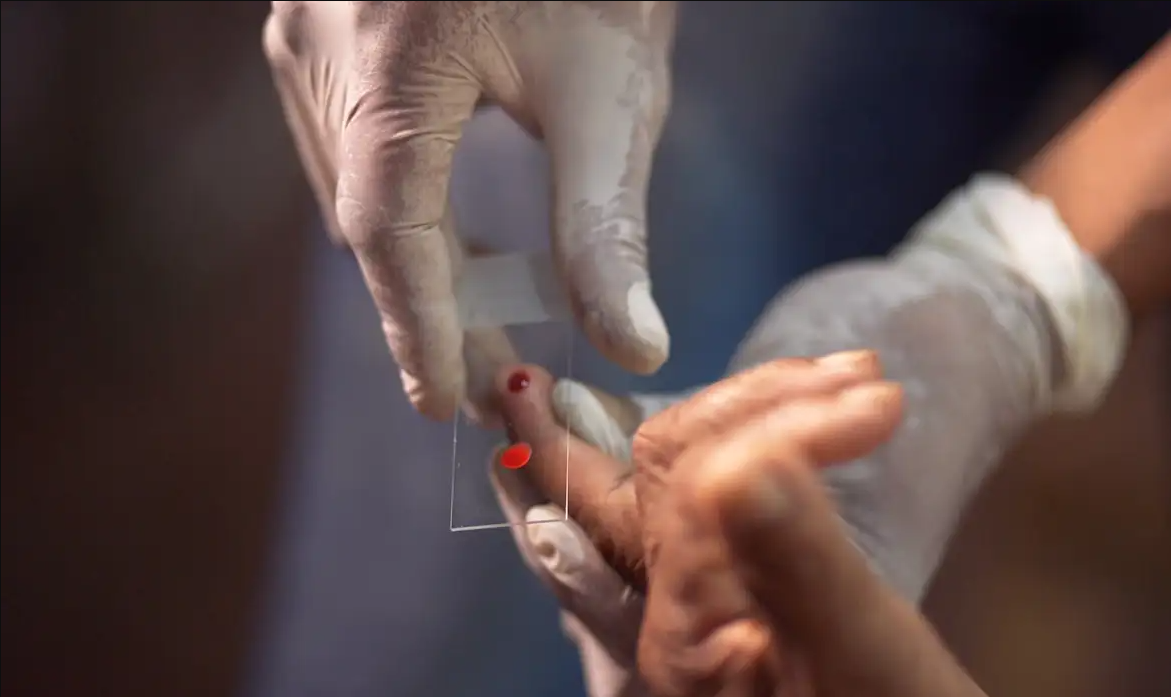 SUS COMEÇA A USAR NOVO TRATAMENTO CONTRA A MALÁRIA EM CRIANÇAS