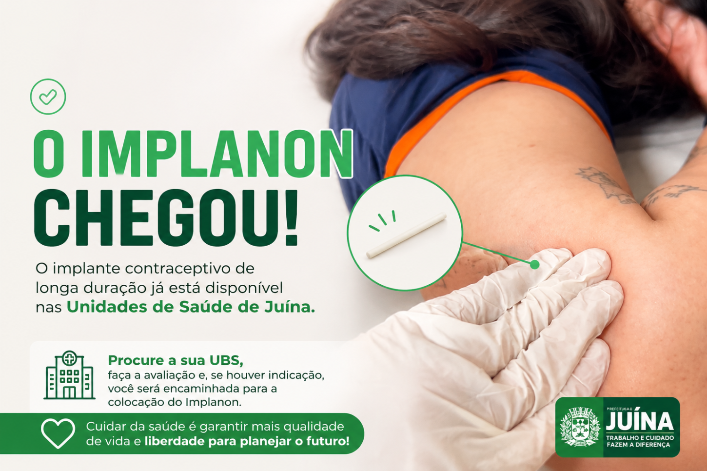 O Implanon chegou às Unidades de Saúde de Juína!
